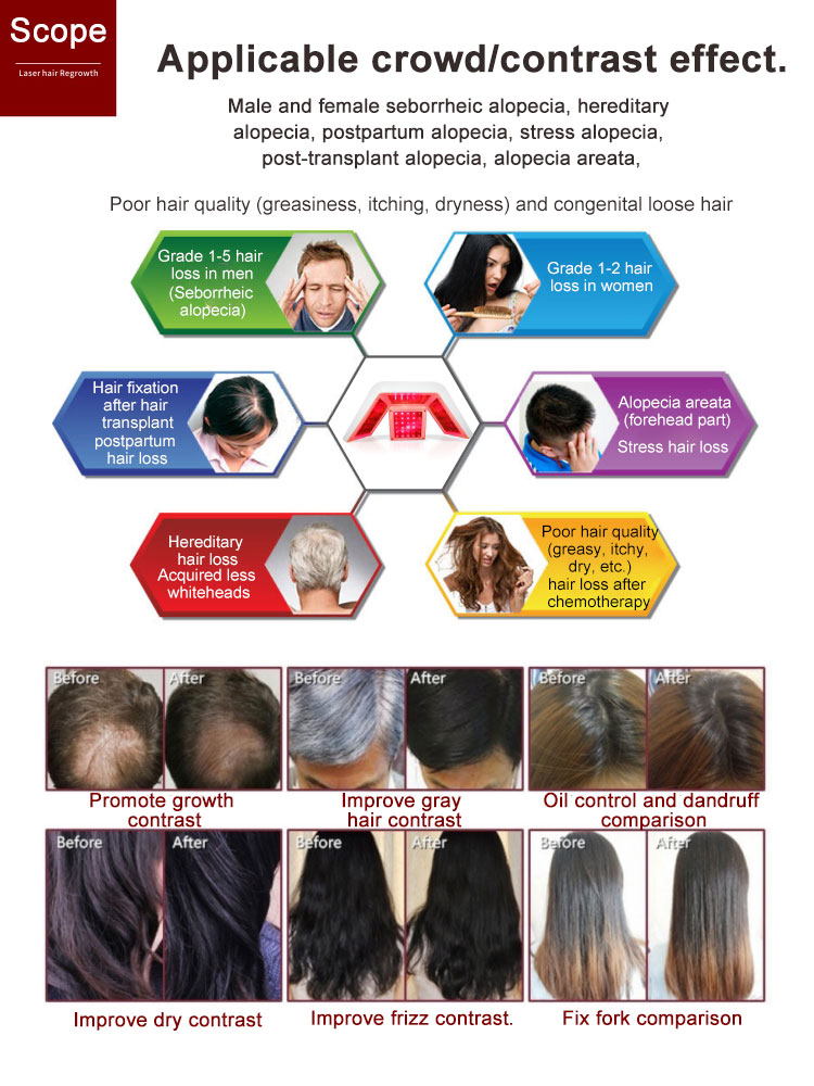 anti hair loss machine